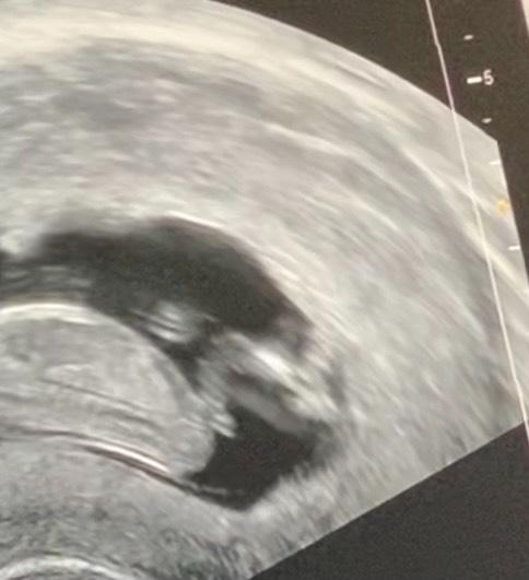 Bild zu Geschlechterraten - was meint ihr? - Forum für Juli - Mamis