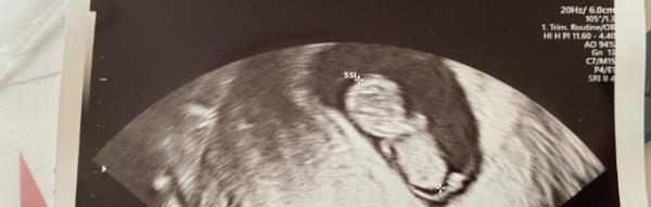 Bild zu 2 neue Bilder - Forum für Juli - Mamis