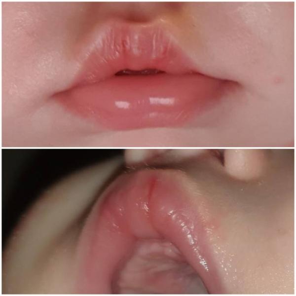 Bild zu Trockene Lippen - Forum für Juli - Mamis