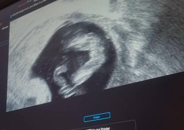 Bild zu So fängt das Jahr (trotzdem) gut an :) - Forum für Juli - Mamis