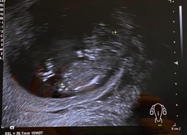 Bild zu Zurück vom FA - verunsichert - Forum für Juli - Mamis