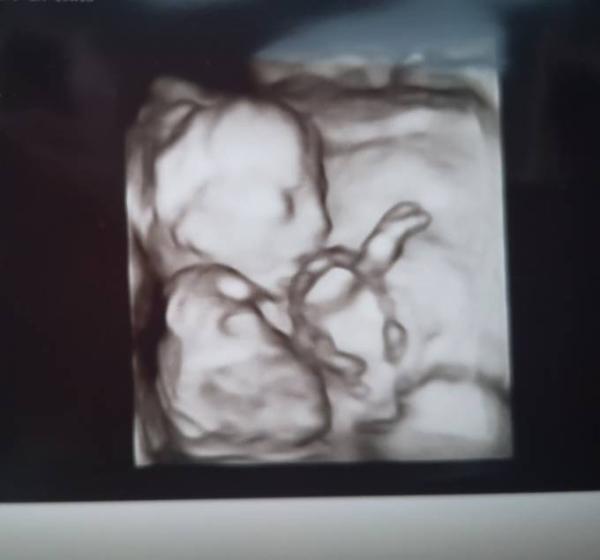 Bild zu Haribo TV, Outing und Bild 🥰 - Forum für Juli - Mamis