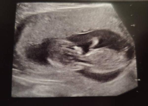 Bild zu Zurück vom FA - Forum für Juli - Mamis