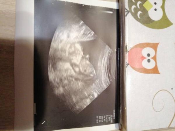 Bild zu Termin super gelaufen - Forum für Juli - Mamis