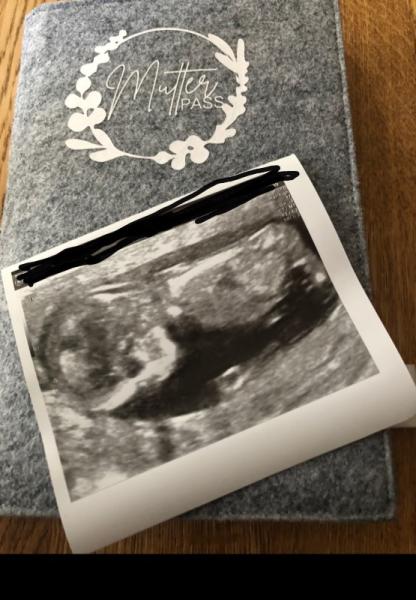 Bild zu Ich komme nicht zur Ruhe/ Ängste - Forum für Juli - Mamis