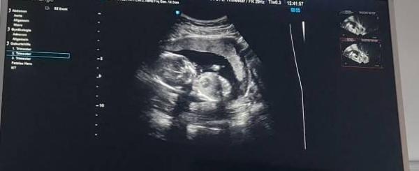 Bild zu Alles supi :) - Forum für Juli - Mamis