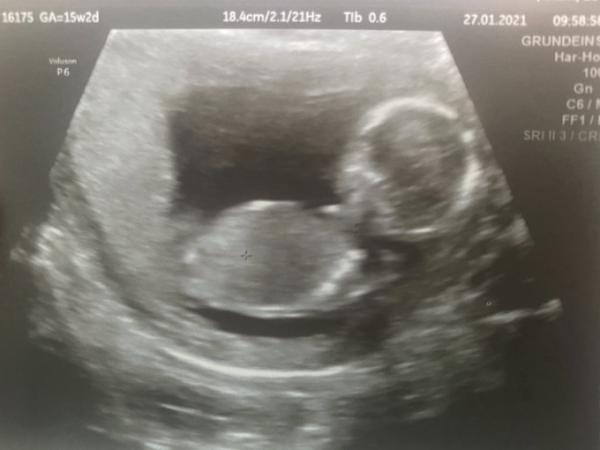 Bild zu Traumtermin beim Doc - Forum für Juli - Mamis