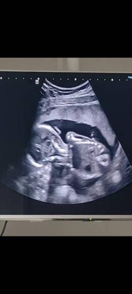 Bild zu Toller Termin zur Halbzeit:) - Forum für Juli - Mamis