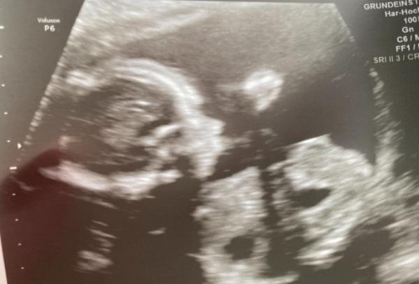Bild zu Screeing ☀️ - Forum für Juli - Mamis