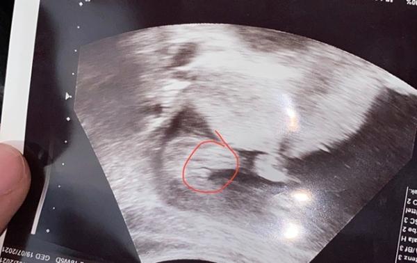 Bild zu Babygeschlecht - Forum für Juli - Mamis