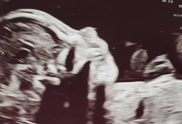 Bild zu Organscreening mit Papa♥️💙 - Forum für Juli - Mamis