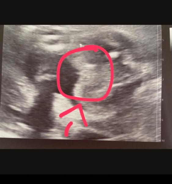 Bild zu Mädchen o. Junge ? - Forum für Juli - Mamis