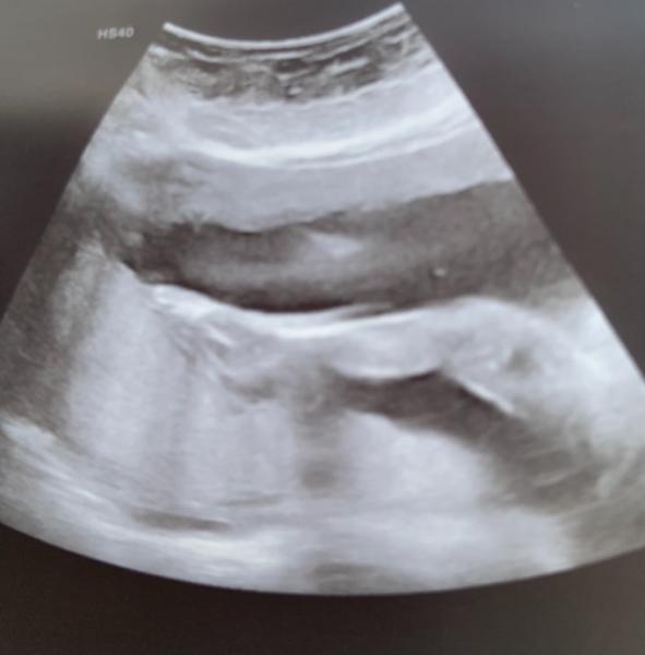 Bild zu Neues vom FA Termin und Beinbild 😅 - Forum für Juli - Mamis