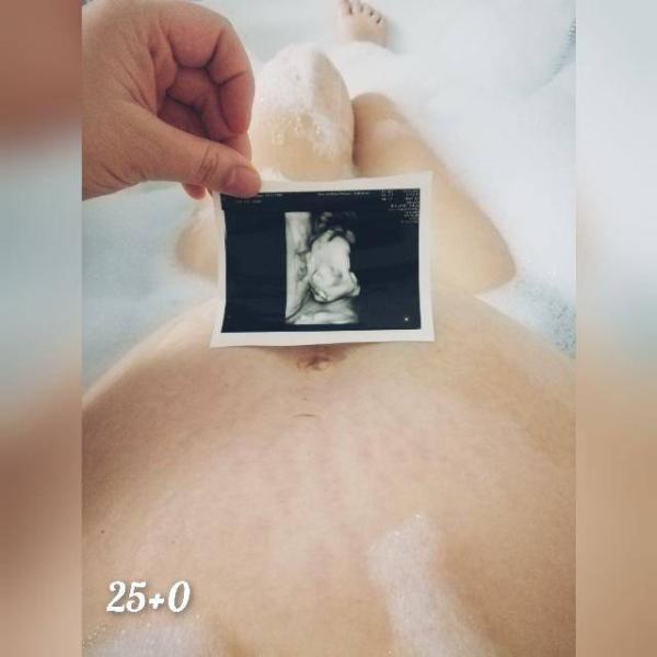 Bild zu Foto ideen - Forum für Juli - Mamis