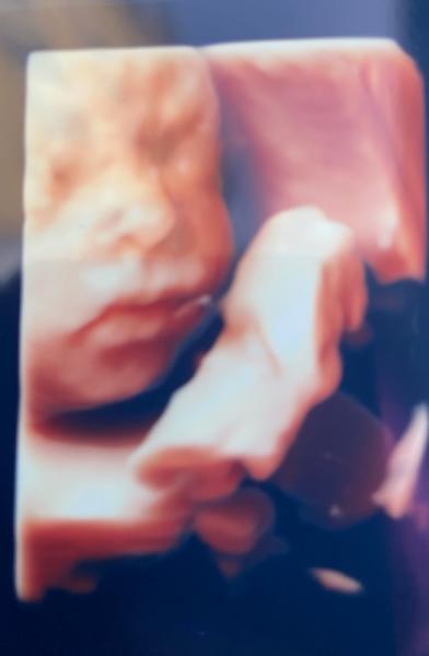 Bild zu Neues Bildchen - Forum für Juli - Mamis