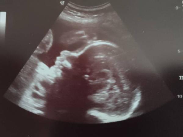 Bild zu Heut wieder Babyfernsehen gehabt - Forum für Juli - Mamis