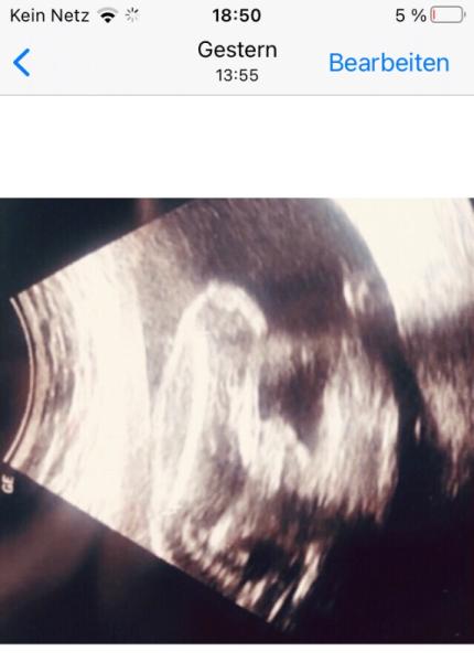 Bild zu Wirklich ein Junge? - Forum für Juli - Mamis