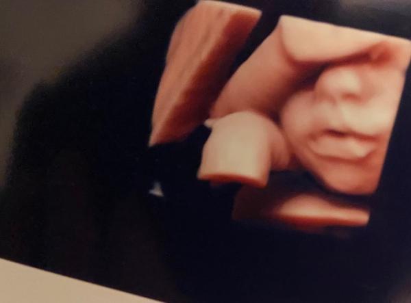Bild zu Letzter „großer“ Ultraschall - Forum für Juli - Mamis