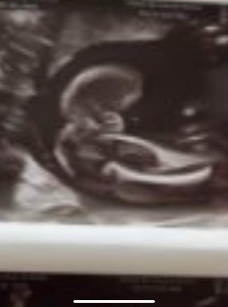Bild zu Hilfe bei Geschlecht.. - Forum für Juli - Mamis