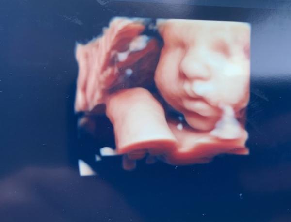 Bild zu Neues Bild - Forum für Juli - Mamis