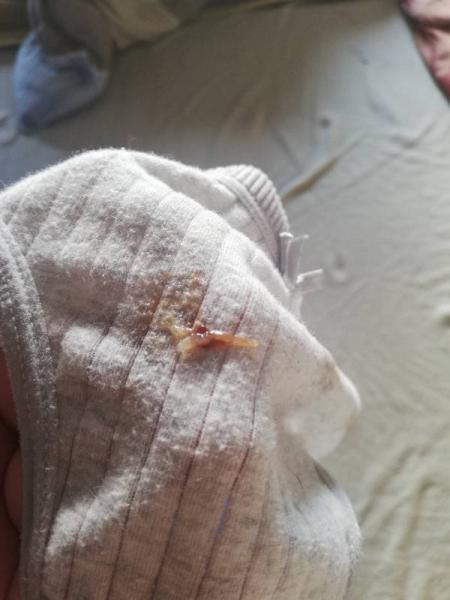 Bild zu Achtung Bild!! Weiß jemand ob das eine Einnistungsblutung sein könnte? - Forum für Juli - Mamis