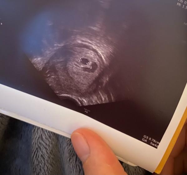 Bild zu Spontaner FA-Termin - Forum für Juli - Mamis