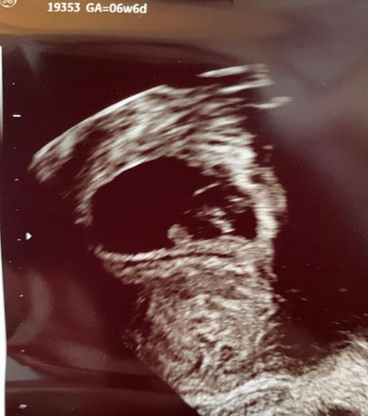 Bild zu 1. Termin beim FA 💕 - Forum für Juli - Mamis