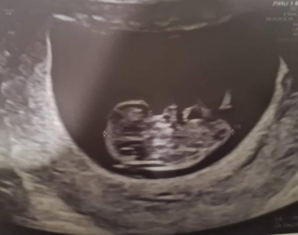 Bild zu 1. Großer Ultraschall - Forum für Juli - Mamis