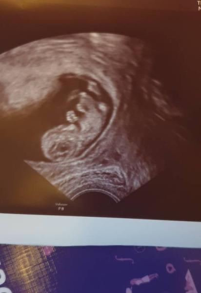 Bild zu Eine schöne Nachricht - Forum für Juli - Mamis
