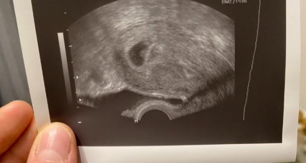 Bild zu Genervt vom Frauenarzt - Forum für Juli - Mamis