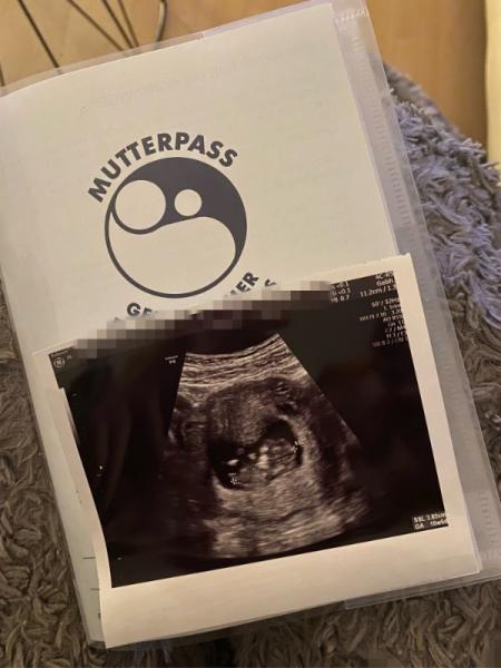 Bild zu Zurück vom Termin ☺️ - Forum für Juli - Mamis