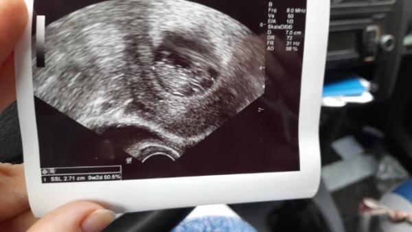 Bild zu Zurück vom Arzt  - Forum für Juli - Mamis