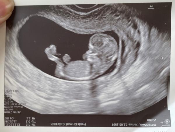 Bild zu Riesen Baby? - Forum für Juli - Mamis