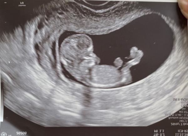 Bild zu Übelkeit weg - bestes geschenk! - Forum für Juli - Mamis