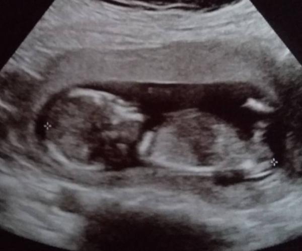 Bild zu ETS vorbei und glücklich - Forum für Juli - Mamis