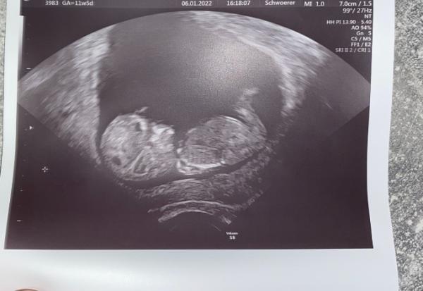 Bild zu So unendlich Happy! - Forum für Juli - Mamis