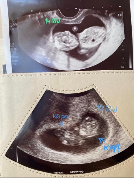 Bild zu US Bild - Forum für Juli - Mamis