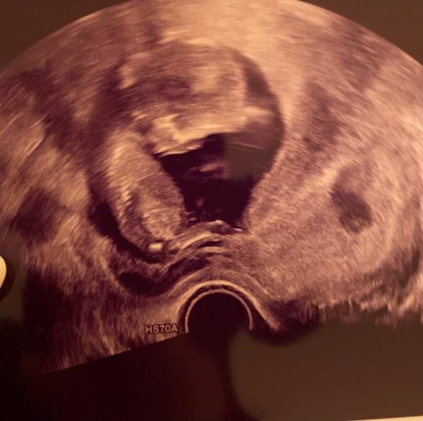 Bild zu Erleichtert 😮‍💨 - Forum für Juli - Mamis