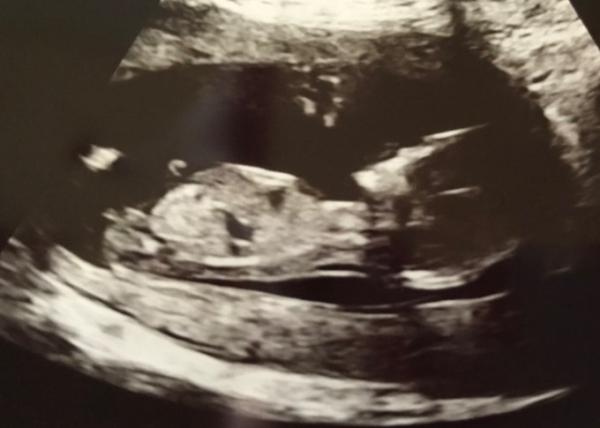Bild zu Zweites Bild von Clara - Forum für Juli - Mamis