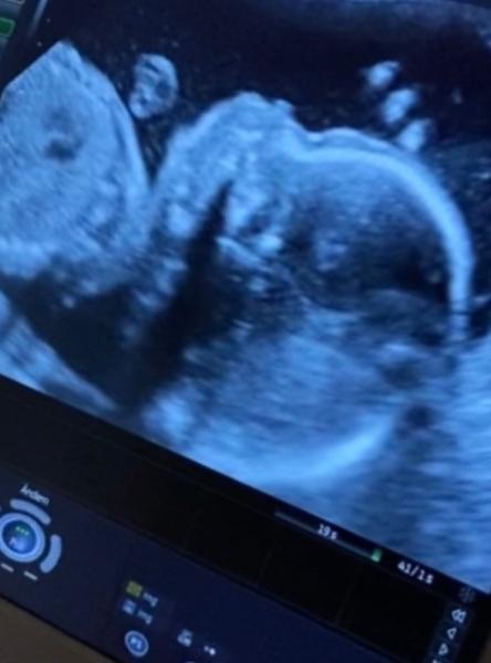 Bild zu Organscreening-happy - Forum für Juli - Mamis