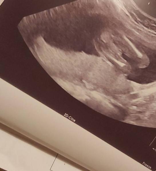 Bild zu Mädchen oder Junge SSW 19 - Forum für Juli - Mamis