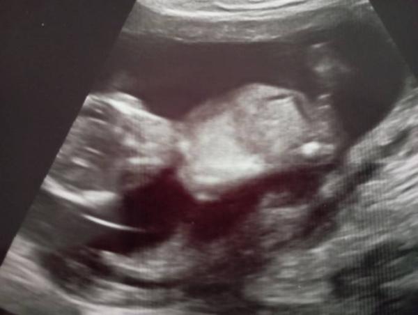 Bild zu Bub oder Mädel?  - Forum für Juli - Mamis