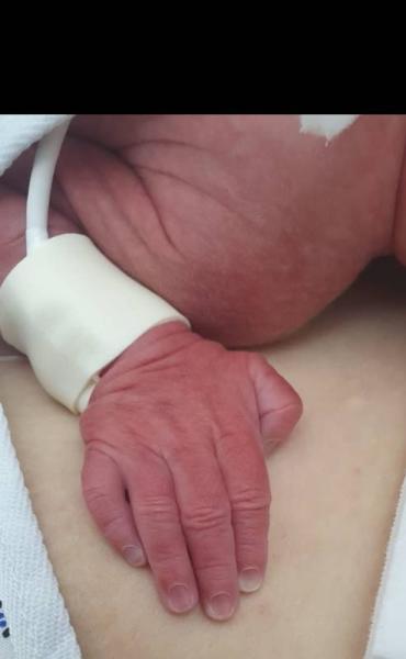 Bild zu Ausgekugelt 31+3 - Forum für Juli - Mamis