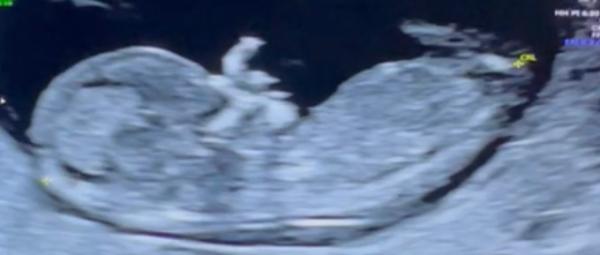 Bild zu NUB SKULL Theorie - Forum für Juli - Mamis