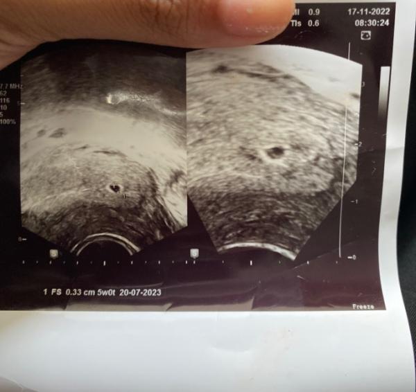 Bild zu Das erste US Bild - Forum für Juli - Mamis
