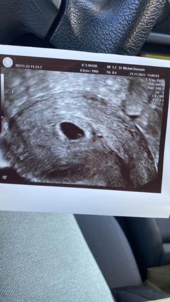 Bild zu 6. Ssw 🥰 - Forum für Juli - Mamis