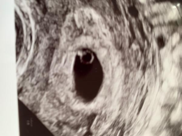 Bild zu Ist das normal….? - Forum für Juli - Mamis