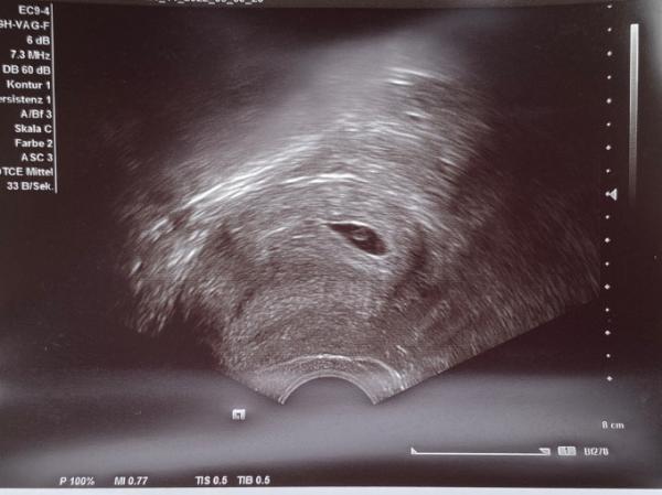 Bild zu Ich bin dabei - Forum für Juli - Mamis