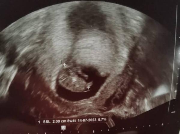 Bild zu Ultraschall 9+1 - Forum für Juli - Mamis