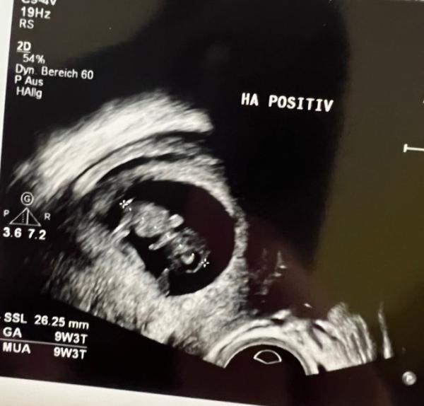 Bild zu US 9+3 - Forum für Juli - Mamis